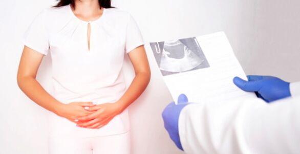 Women with doctor-diagnosed bacterial cystitis